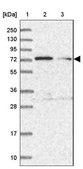 Anti-TTC12 antibody produced in rabbit Prestige Antibodies® Powered by Atlas Antibodies, affinity isolated antibody, buffered aqueous glycerol solution