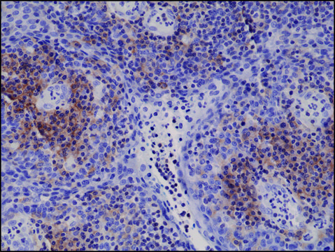 Anti-Integrin alpha 4 antibody, Rabbit monoclonal recombinant, expressed in HEK 293 cells, clone RM268, purified immunoglobulin