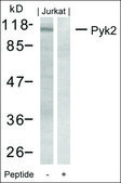 Anti-PTK2B (Ab-402) antibody produced in rabbit affinity isolated antibody