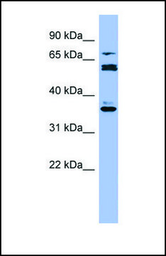 Anti-CYP2B6 antibody produced in rabbit affinity isolated antibody