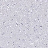 Anti-SLC5A1 antibody produced in rabbit Prestige Antibodies® Powered by Atlas Antibodies, affinity isolated antibody, buffered aqueous glycerol solution