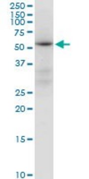 Anti-ALDH4A1 antibody produced in mouse purified immunoglobulin, buffered aqueous solution