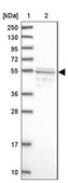 Anti-SRFBP1 antibody produced in rabbit Prestige Antibodies® Powered by Atlas Antibodies, affinity isolated antibody, buffered aqueous glycerol solution