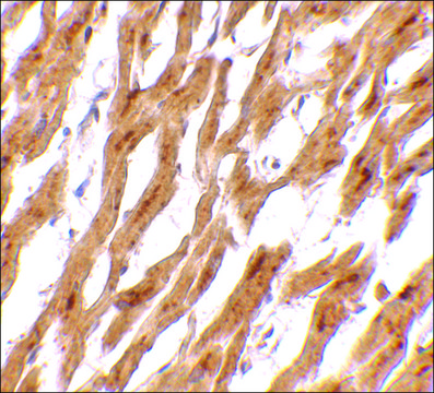 Anti-ASAH1 antibody produced in rabbit affinity isolated antibody, buffered aqueous solution