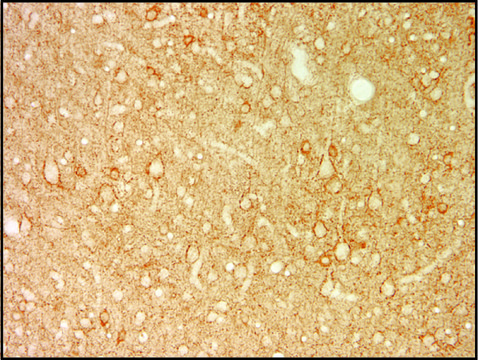 单克隆抗-谷氨酸脱羧酶 67（GAD67） 小鼠抗 clone K-87, purified antibody