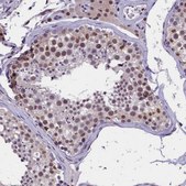 Anti-ZC3H4 antibody produced in rabbit Prestige Antibodies® Powered by Atlas Antibodies, affinity isolated antibody, buffered aqueous glycerol solution