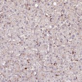 Anti-CHMP4B antibody produced in rabbit Prestige Antibodies® Powered by Atlas Antibodies, affinity isolated antibody, buffered aqueous glycerol solution