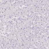 Anti-ACR antibody produced in rabbit Prestige Antibodies® Powered by Atlas Antibodies, affinity isolated antibody, buffered aqueous glycerol solution