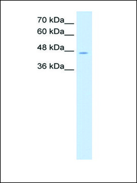 Anti-NDRG1 (AB1) antibody produced in rabbit IgG fraction of antiserum