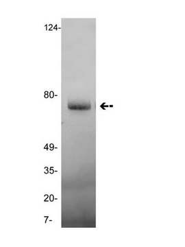 Anti-Vitronectin Antibody, clone GMA-900 clone GMA-900, Upstate&#174;, from mouse