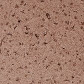 Monoclonal Anti-LAMP1 antibody produced in mouse Prestige Antibodies® Powered by Atlas Antibodies, clone CL4463, purified immunoglobulin