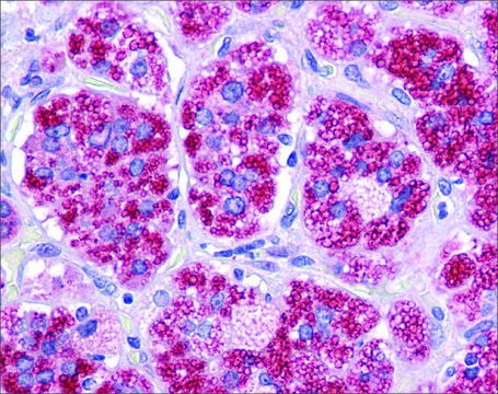 Anti-RAD51 antibody produced in rabbit affinity isolated antibody