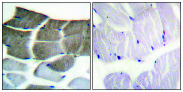 Anti-ACC1 antibody produced in rabbit affinity isolated antibody