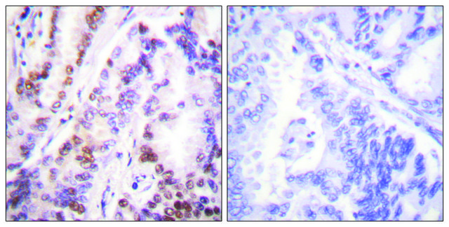 Anti-HDAC9 antibody produced in rabbit affinity isolated antibody