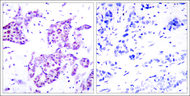 Anti-phospho-STAT6 (pTyr641) antibody produced in rabbit affinity isolated antibody