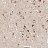 Anti-TIMM17A antibody produced in rabbit Prestige Antibodies® Powered by Atlas Antibodies, affinity isolated antibody, buffered aqueous glycerol solution