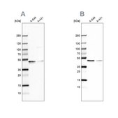 Anti-EPHX1 antibody produced in rabbit Prestige Antibodies® Powered by Atlas Antibodies, affinity isolated antibody, buffered aqueous glycerol solution
