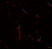 Rhodamine Labeled D-galactosamine Suitable for fluorescent microbial imaging