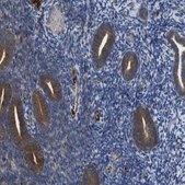 Anti-CLCC1 antibody produced in rabbit Prestige Antibodies® Powered by Atlas Antibodies, affinity isolated antibody, buffered aqueous glycerol solution