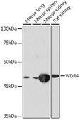 Anti-WDR4 antibody produced in rabbit