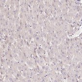 Anti-CENPF Prestige Antibodies® Powered by Atlas Antibodies, affinity isolated antibody