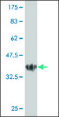 ANTI-GUCY2C antibody produced in mouse clone 3C2, purified immunoglobulin, buffered aqueous solution