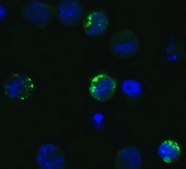 Anti-SARS-CoV-2 (COVID-19) Spike S1 antibody produced in rabbit affinity isolated antibody