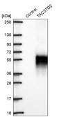 Anti-TACSTD2 antibody produced in rabbit Prestige Antibodies® Powered by Atlas Antibodies, affinity isolated antibody, buffered aqueous glycerol solution