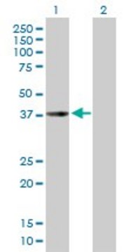 Anti-CHI3L2 antibody produced in mouse purified immunoglobulin, buffered aqueous solution