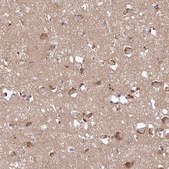 Anti-C17ORF51 antibody produced in rabbit Prestige Antibodies® Powered by Atlas Antibodies, affinity isolated antibody, buffered aqueous glycerol solution