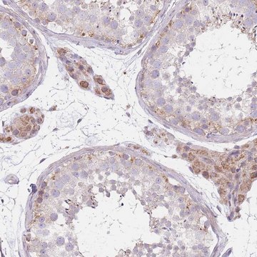 Anti-SMPD4 antibody produced in rabbit Prestige Antibodies&#174; Powered by Atlas Antibodies, affinity isolated antibody, buffered aqueous glycerol solution