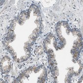 Anti-BCKDK antibody produced in rabbit Prestige Antibodies® Powered by Atlas Antibodies, affinity isolated antibody, buffered aqueous glycerol solution
