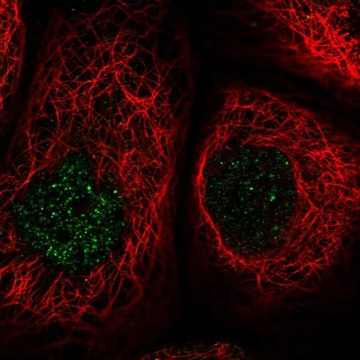 Anti-MCM8 antibody produced in rabbit Prestige Antibodies&#174; Powered by Atlas Antibodies, affinity isolated antibody