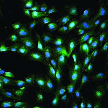 Anti-von Willebrand Factor antibody produced in rabbit IgG fraction of antiserum, buffered aqueous solution