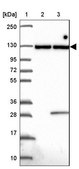 Anti-INTS8 antibody produced in rabbit Prestige Antibodies® Powered by Atlas Antibodies, affinity isolated antibody, buffered aqueous glycerol solution