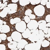 Anti-YOD1 antibody produced in rabbit Prestige Antibodies® Powered by Atlas Antibodies, affinity isolated antibody, buffered aqueous glycerol solution, ab1