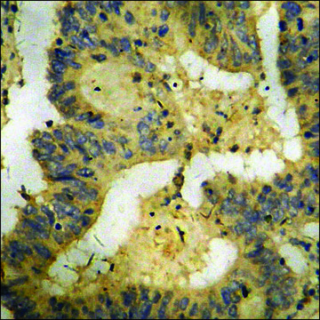 抗-磷酸化-CaMK4 (pThr196/200) 兔抗 affinity isolated antibody