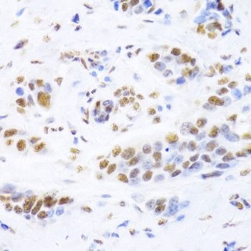 Anti-XRCC5 antibody produced in rabbit