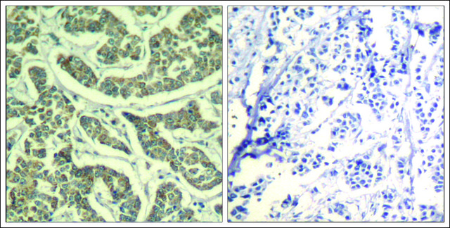 Anti-ATR (Ab-428) antibody produced in rabbit affinity isolated antibody