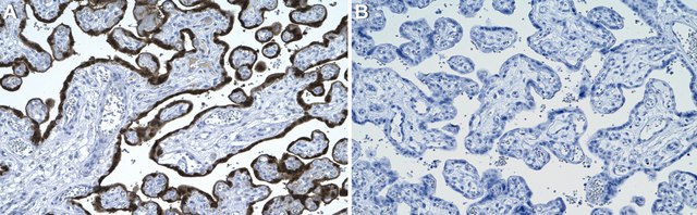 Anti-HOPX Antibody, clone 2L10 ZooMAb&#174; Rabbit Monoclonal recombinant, expressed in HEK 293 cells