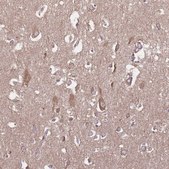 Anti-KIF16B antibody produced in rabbit Prestige Antibodies® Powered by Atlas Antibodies, affinity isolated antibody, buffered aqueous glycerol solution
