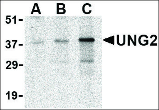 Anti-UNG2 (ab1) antibody produced in rabbit affinity isolated antibody, buffered aqueous solution