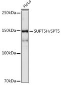 Anti-SUPT5H/SPT5 Antibody, clone 9V9G7, Rabbit Monoclonal