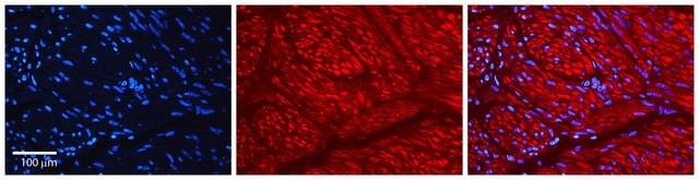 Anti-AHR (AB1) antibody produced in rabbit IgG fraction of antiserum