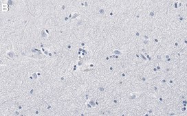 Anti-Aldh1L1 Antibody, clone N103/39 ZooMAb® Mouse Monoclonal recombinant, expressed in HEK 293 cells