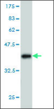 Monoclonal Anti-PPP1R9A antibody produced in mouse clone 6A10, purified immunoglobulin, buffered aqueous solution