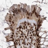 Anti-PPP1R8 antibody produced in rabbit Prestige Antibodies® Powered by Atlas Antibodies, affinity isolated antibody, buffered aqueous glycerol solution, Ab3