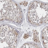 Anti-LZIC antibody produced in rabbit Prestige Antibodies® Powered by Atlas Antibodies, affinity isolated antibody, buffered aqueous glycerol solution
