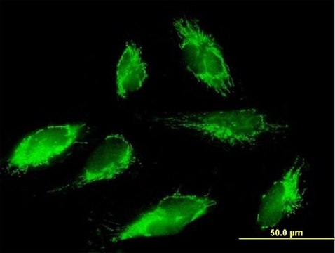 Anti-SCO1 antibody produced in mouse IgG fraction of antiserum, buffered aqueous solution