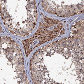 Anti-MIER2 antibody produced in rabbit Prestige Antibodies® Powered by Atlas Antibodies, affinity isolated antibody, buffered aqueous glycerol solution